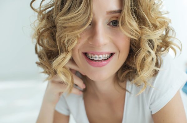 L’appareillage dentaire à l’âge adulte L’appareillage dentaire à l’âge adulte